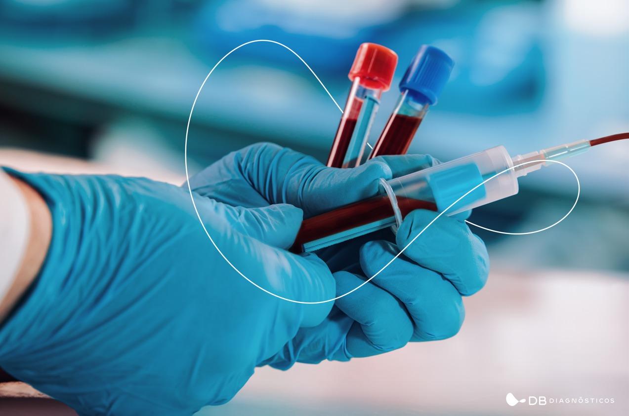 Do pré ao pós-analítico: Como funciona um exame de sangue?